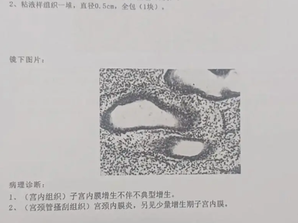 移植成功后内膜降低怎么回事