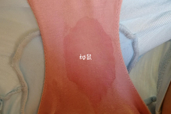 没足月羊水破了要及时保胎