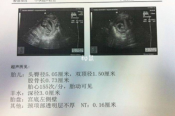 28周胎儿b超各项标准值公布