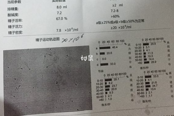 男性精子质量差可能是过于肥胖导致的