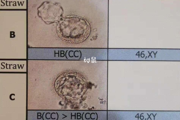 试管基因筛查后不一定没问题