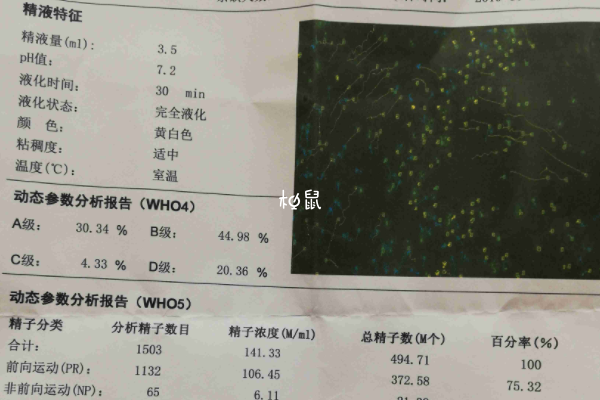 男性精子检查要查活力