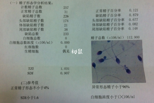 精子检查一般禁欲2-7天