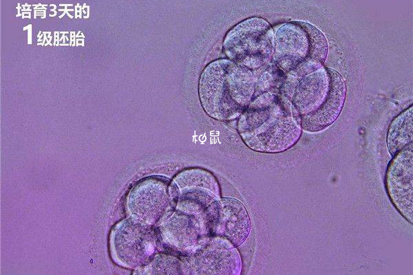 基因问题需要通过三代试管怀孕