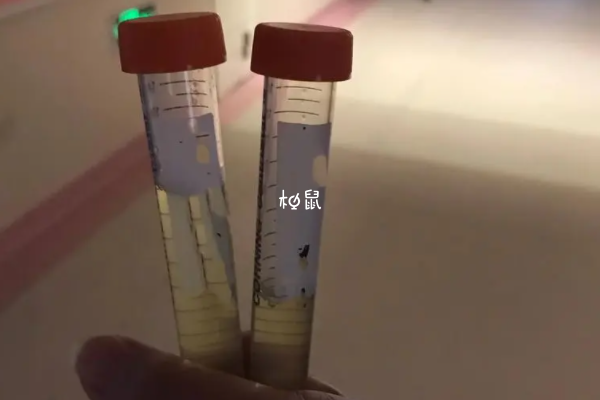 高龄做试管不用做羊水穿刺